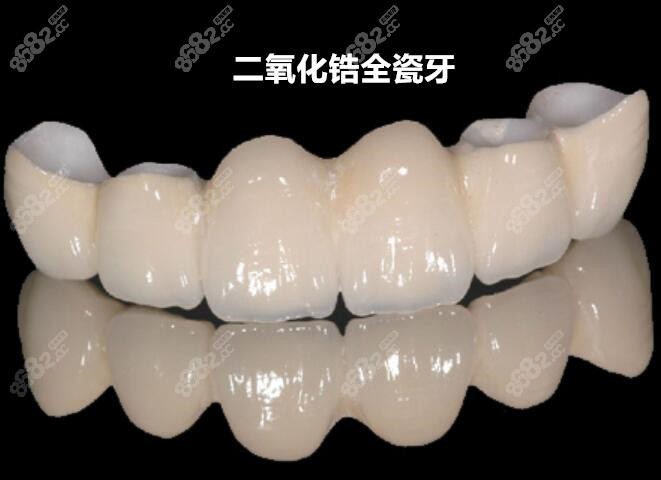 二氧化铝全瓷牙价格变动与追求自信成就感的关联探索
